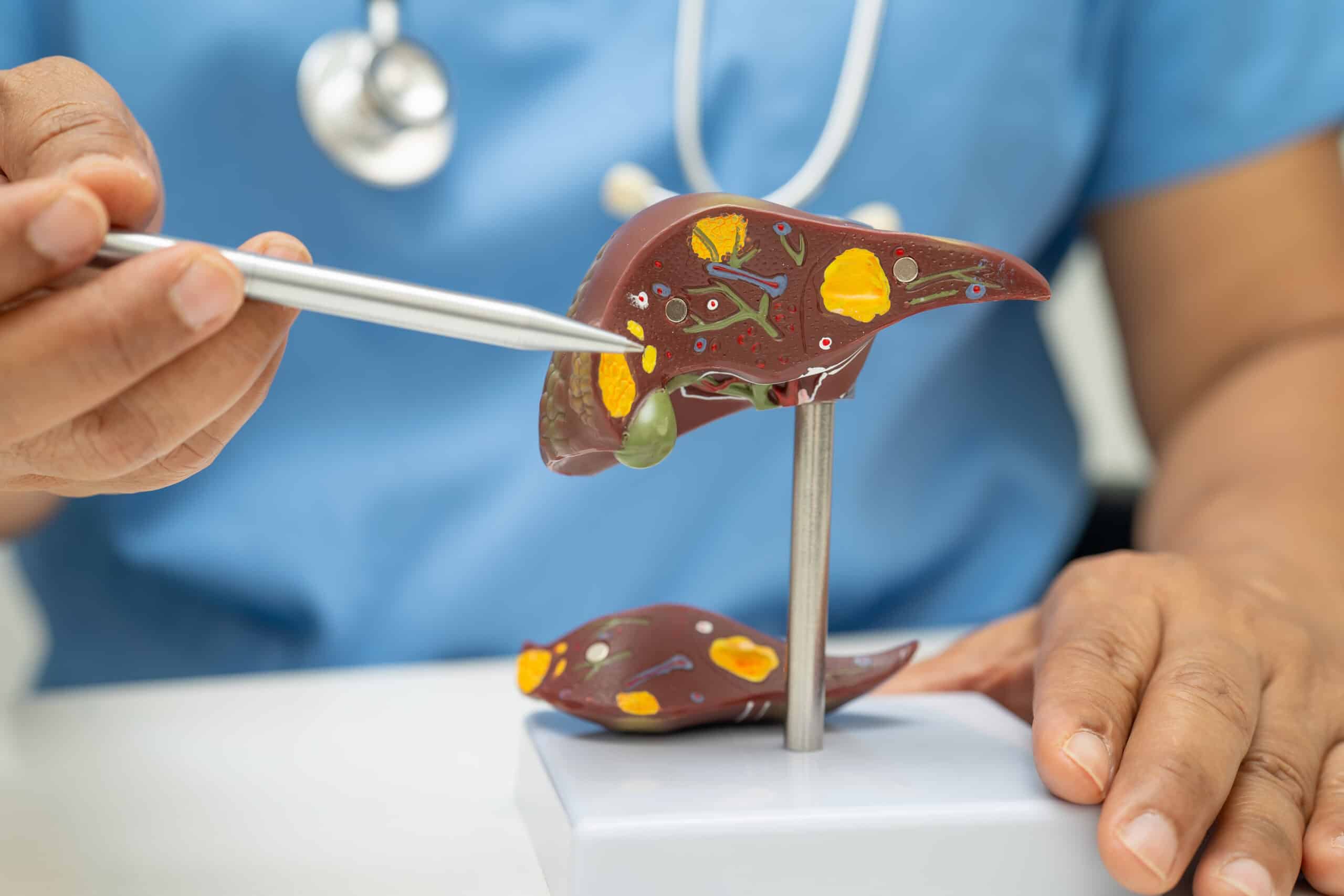 Semaglutide Making Headlines Again: New Study Reveals Breakthrough in Treating Fatty Liver Disease