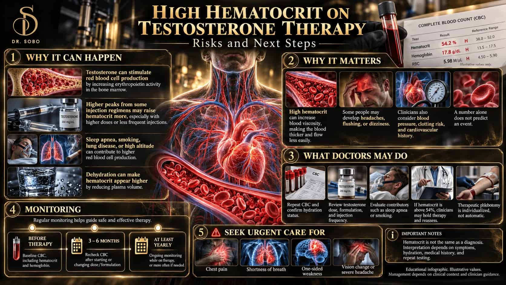 High hematocrit on testosterone therapy infographic showing bone marrow red blood cell production, a 54.2% example hematocrit, monitoring schedule, and clinical next steps